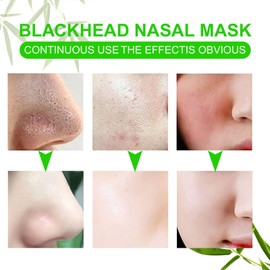 Mitesserpflaster, 80 Streifen Mitesser Nase Bambuskohle für die Tiefenreinigung, Mitesser entfernen und befreien verstopfte Poren, stellen die Gesundheit der Haut wieder her, geeignet für Frauen und M