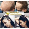 Immediately Thick Hair XXL Premium Hair Thickening Scattered Hair Trading