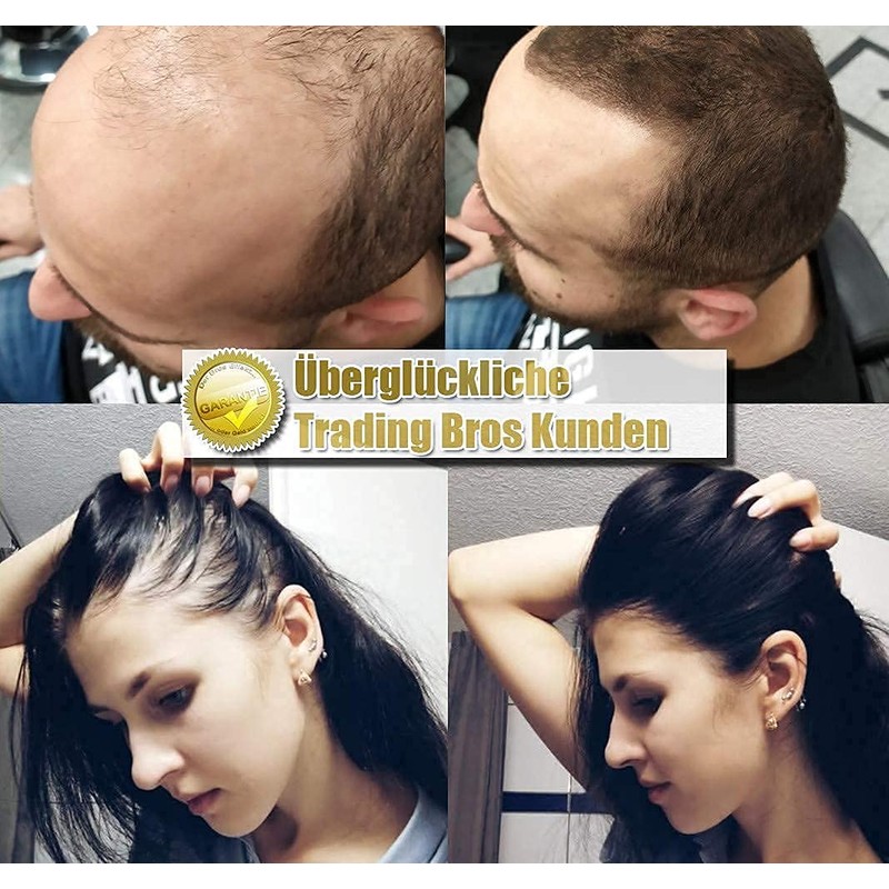 Immediately Thick Hair XXL Premium Hair Thickening Scattered Hair Trading