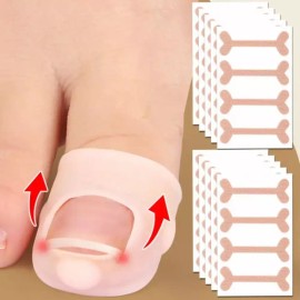 세트 밴드40P 실리콘 교정기2P 관리 트렌드 인기 Set Band 40P Silicon Orthodontic 2P Management Trend Popular [Ingrown Toenail Correction Set (]