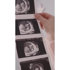 Gel Condutor Para Ultrasonido 5.lts. Hipoalergénico Factura Sin Olor