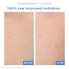 AtoBarrier 365 Lotion 150ml /5oz K-beauty For dry, delicate skin