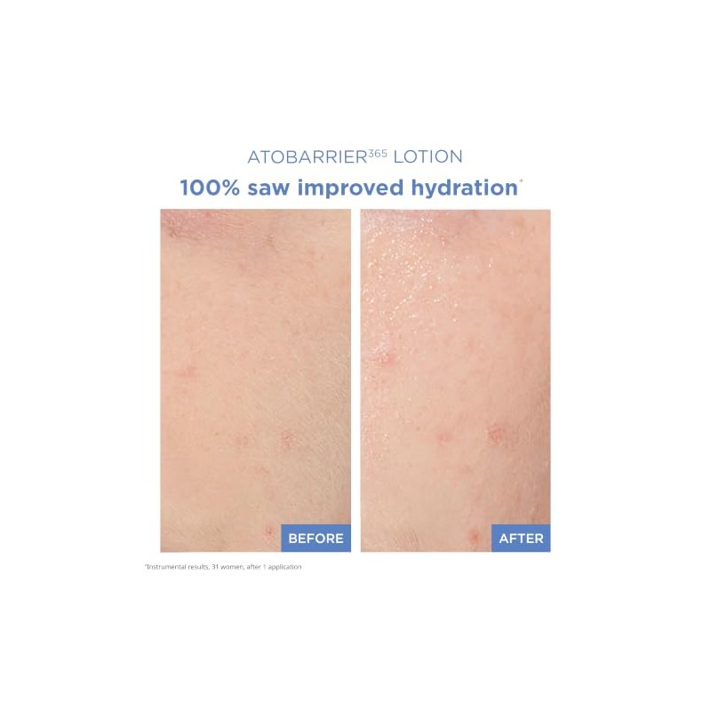 AtoBarrier 365 Lotion 150ml /5oz K-beauty For dry, delicate skin