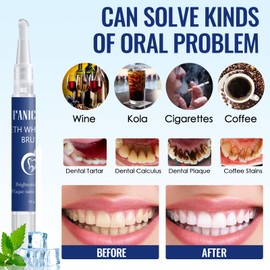 Pack of 2 Teeth Whitening Pen, Teeth Whitening Pen, Fast Bleaching Teeth, Effective Removal of Teeth Stains, Easy Teeth Whitening Bleaching at Home