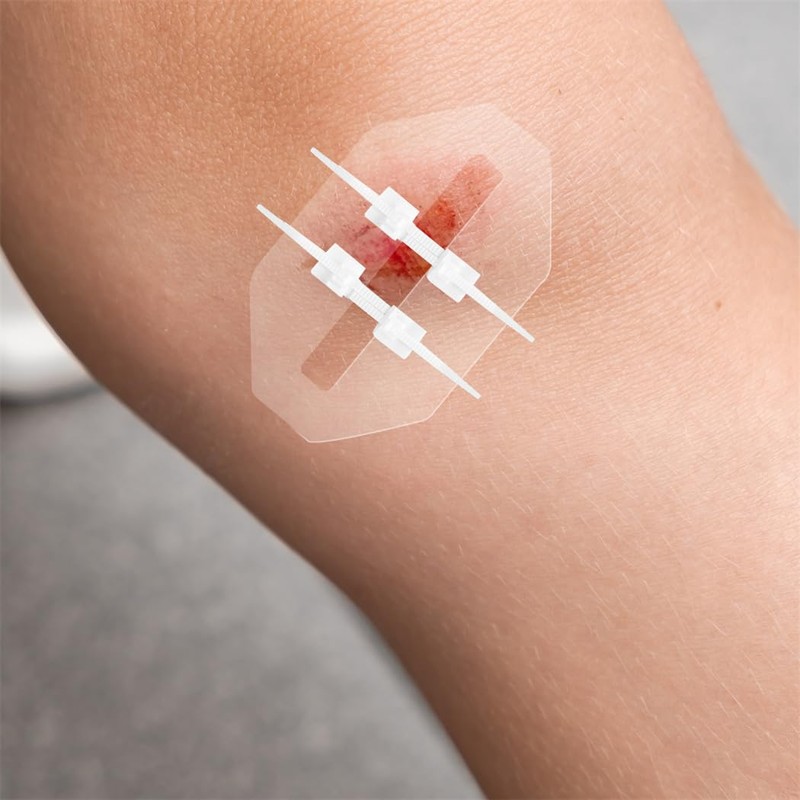 Wound Closure Strips, Pack of 2, Wound Closure Strips, Wound