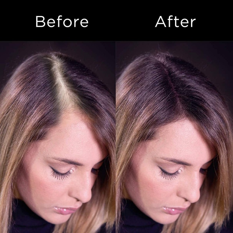 R-Kerhair 100% Natural Keratin Stacking Fibres with Applicator and Optional