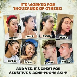 Daily Facial Moisturizer for Collagen  Boost | Anti-Wrinkle Hyaluronic Acid Moisturizer Cream | Day & Night Deep Moisturizing Face Cream | 1.76 oz. - Specification: 5 bottle