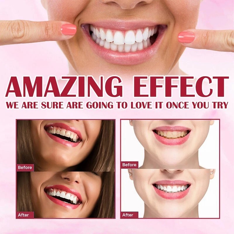 SP-6 Ultra Brightening Probiotics Toothpaste - 120g Sensitive Teeth Whitening