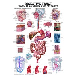 Anatomical Worldwide The Digestive Tract Normal and Diseased Laminated Anatomy Chart