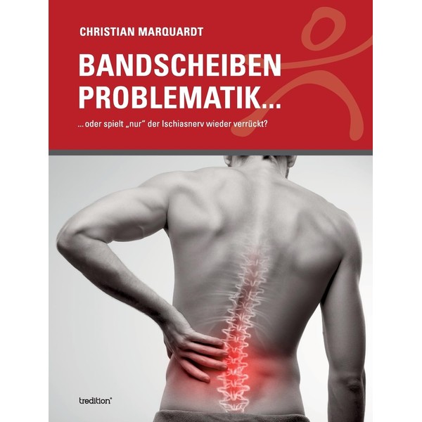 Bandscheiben Problematik: ... oder spielt „nur“ der Ischiasnerv wieder verrückt?