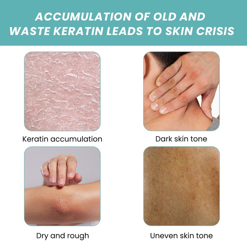 Acidified Body Wash (B)