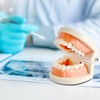 Dental Caries Teaching Model 1:1 Adult Life Size - Non-Removable