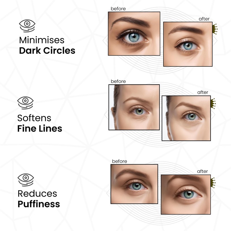 Revitale Hyaluronic Acid & Peptides Pure Under Eye Patches, Packets