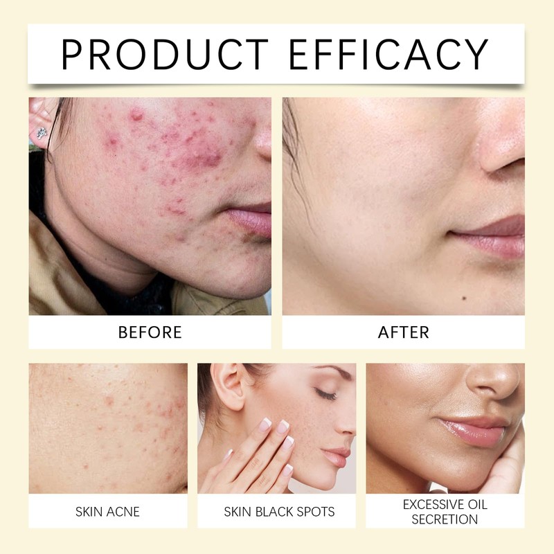 Kojic Acid Turmeric Cleansing Pad