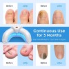 Dispositivo Ligero Para Hongos En Las Uñas De Los Pies