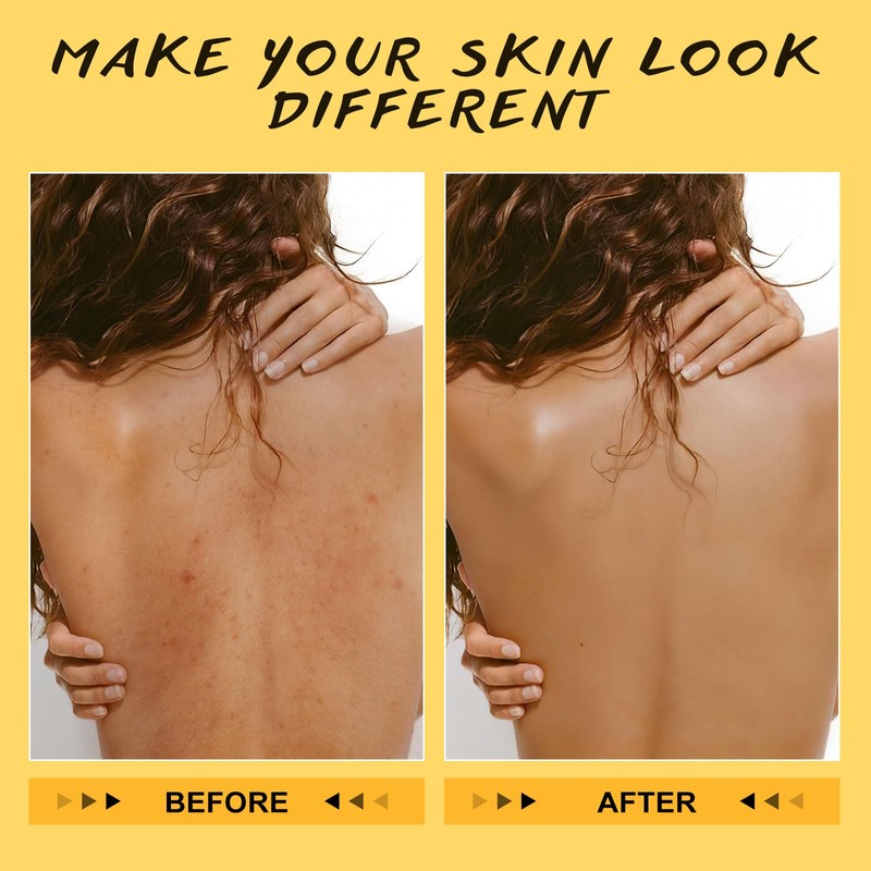 Turmeric and Vitamin C Body Scrub Exfoliating Deep Cleansing Exfoliator