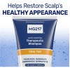Shampoo Terapéutico Psoriasis Mg217 240ml Alquitrán Carbon
