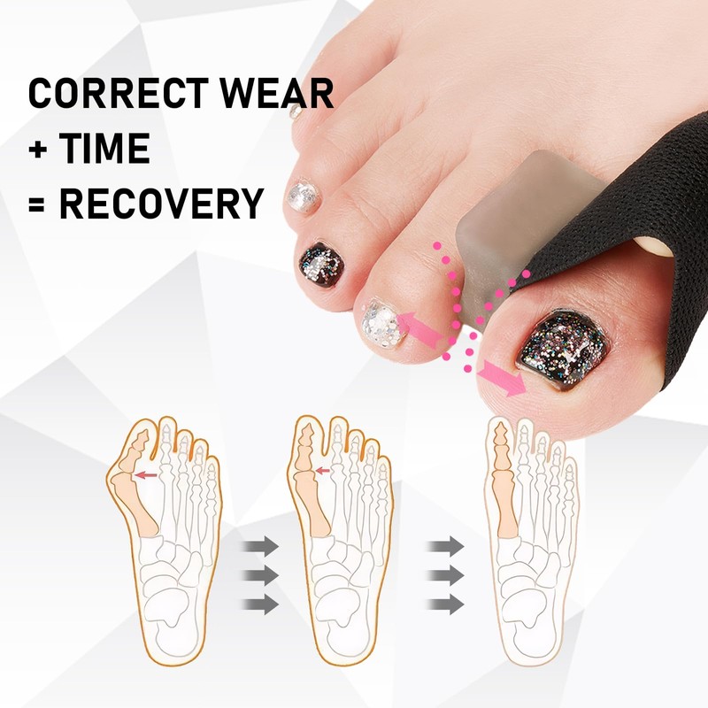 6 Toe Separator,Toe Separators for Overlapping Toes for Men and