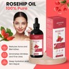 Aceite de Rosa Mosqueta Aekonik – Reduce cicatrices y arrugas,