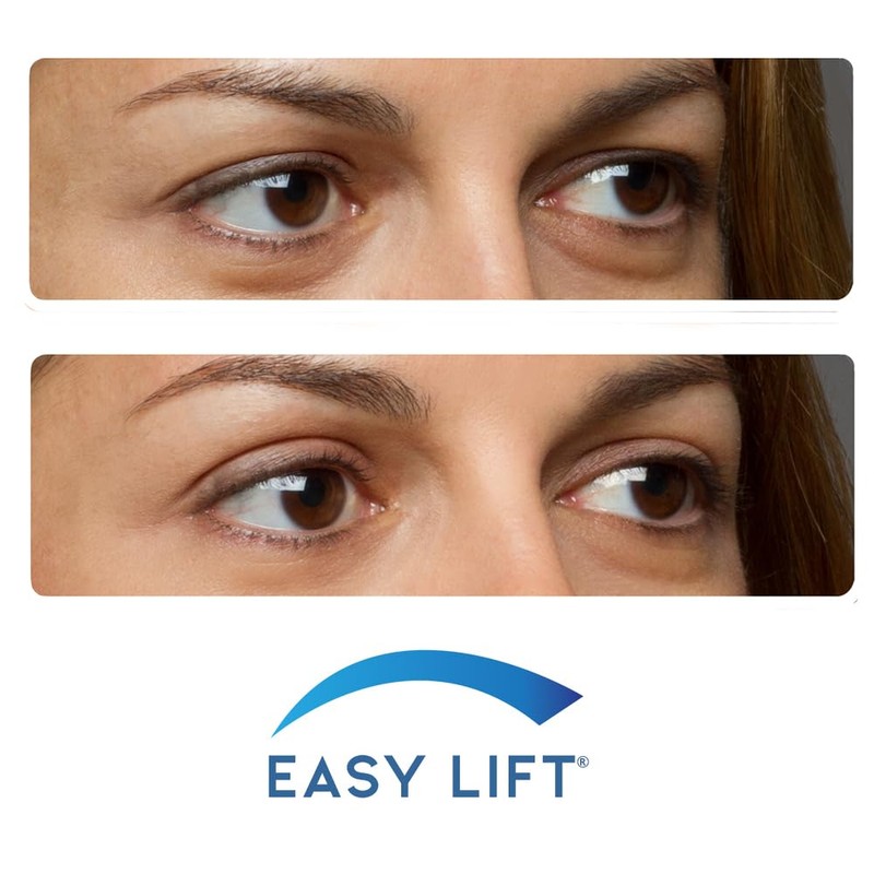 EasyLift The Original 60 Second Eye Lift Strips | Instant