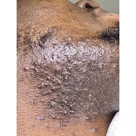 CWHaircare Black Beard beard elixir is an all natural beard growth product that conditions, softens, grows, helps to prevent razor bumps, also adds a beautiful healthy shine and it smells AMAZING!!!