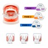 Retenedor De Dientes Para Corrección De Sonrisa 3 Etapas Dispositivo