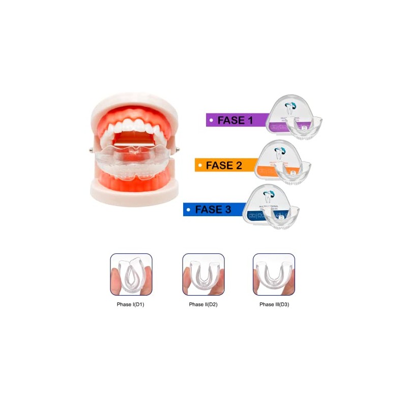 Retenedor De Dientes Para Corrección De Sonrisa 3 Etapas Dispositivo