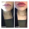 Suero Labios Voluminizador Lipgloss Hidratación Colágeno