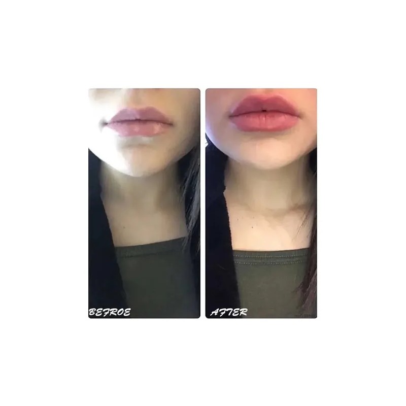 Suero Labios Voluminizador Lipgloss Hidratación Colágeno
