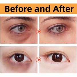 60 PCS Vitamin C & Collagen Eye Pads for Dark Circles,Under Ey/e Patches Masks,Anti Wrinkle Pa/tches & Eye Bags Remover for Anti Aging,Collagen Patches Eye Masks with Moisturizing and Anti-Aging