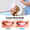 LiFuJunDong Tooth Bleaching Mobile Teeth Whitening Machine System Whitening Cold