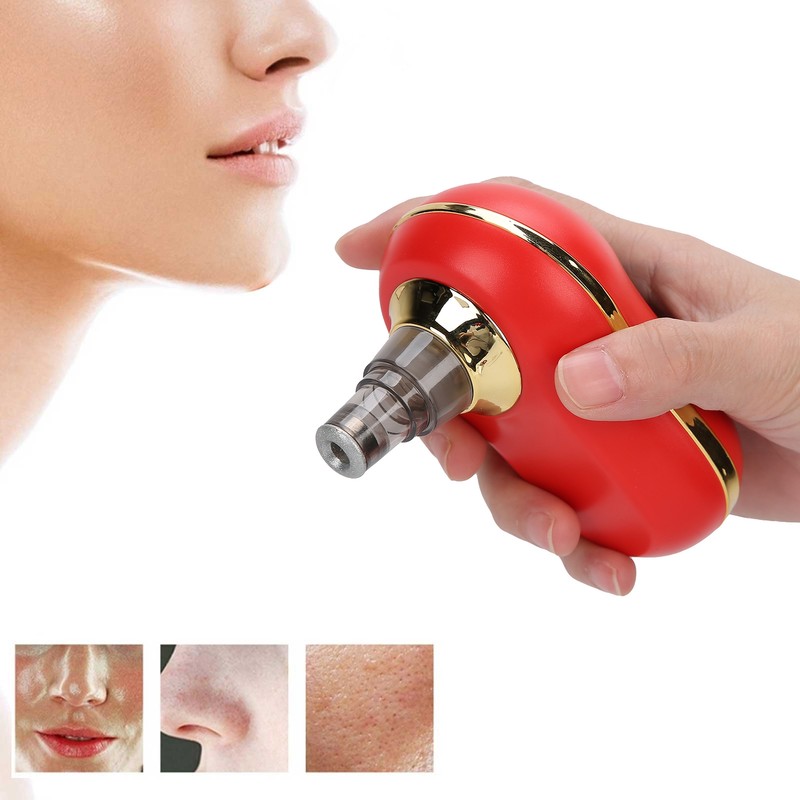 USB Charging Electric Blackhead Removal Machine Vacuum Suction Face Pore