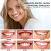 SSKHE Pack of 28 Teeth Whitening Bands, 9D Teeth Whitening
