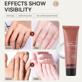 2PCS Retinol Hand Cream, Firming Anti-Aging Hand Lotion with Collagen, Relief Intense Moisture Hand Cream, Retinol Moisturizer for Aging & Dry Cracked Hands, Care & Protects Skin, Nails & Cuticles