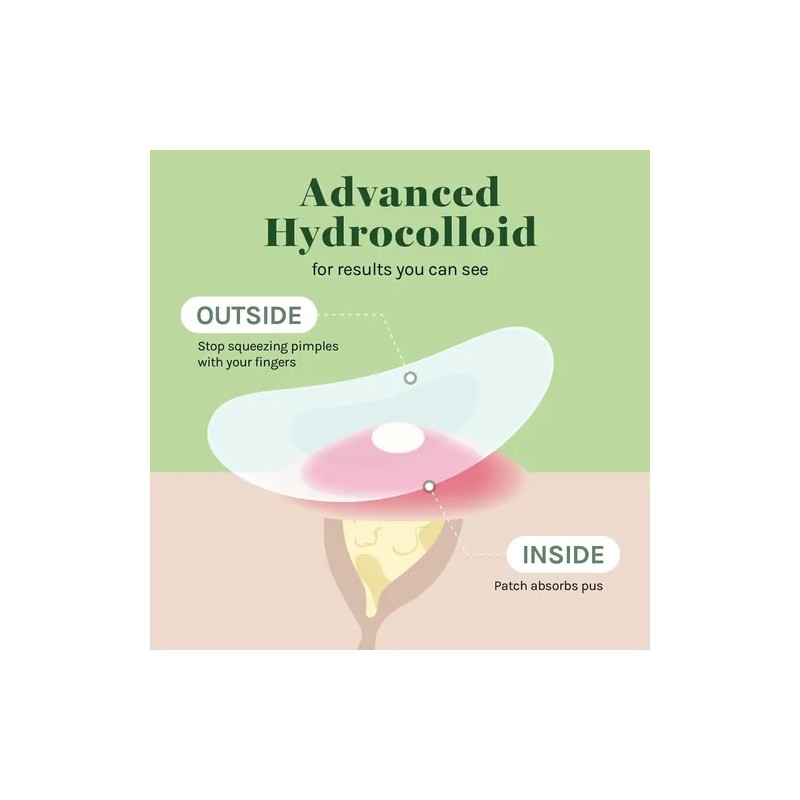 Cover Healing Invisible Acne Patch Blemish Spot, Treatment,