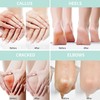 Urea Cream 50 Percent for Feet with Coconut 5.29 oz