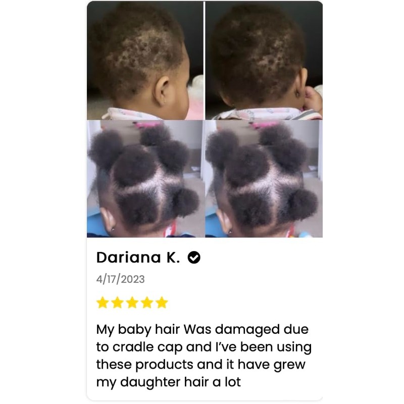 J'Organic Solutions - Estimulador de crecimiento del cabello (hecho a