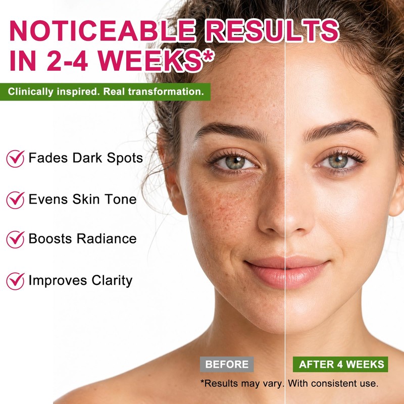 O.SECERT Arbutin 7% + Tranexamic Acid 4% Dark Spot Corrector