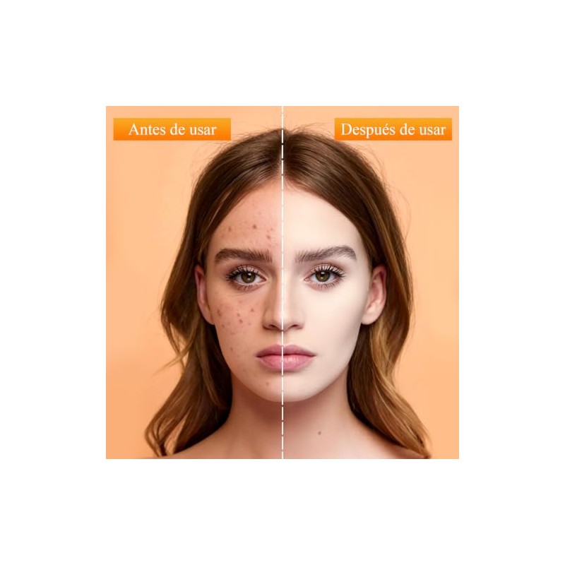 2PCS Crema Hidratante Facial para Atenuar las Manchas Oscuras
