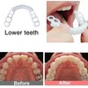 2 Pairs, Temporarily Adjustable for Men and Women, Beautiful Smile