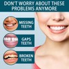 Instant Veneers Dentures,Clip in Veneers Teeth,Snap on Veneers Teeth,Fake Braces,False
