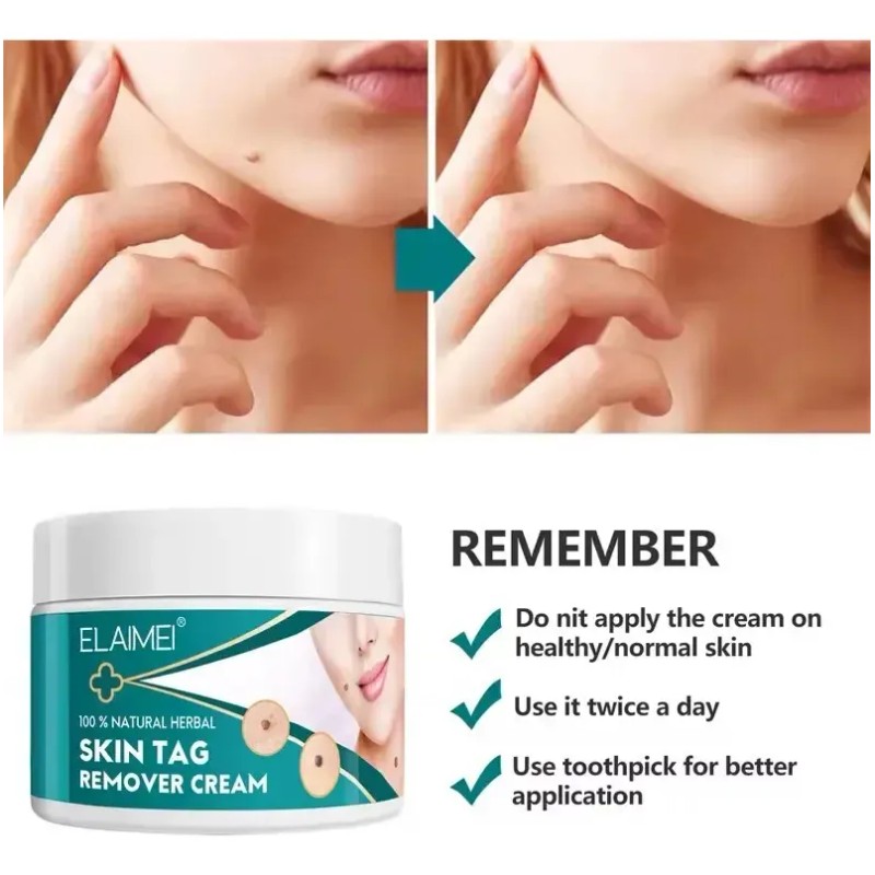 Crema Removedora Eficaz Mezquinos Verrugas Lunares Sin Dolor