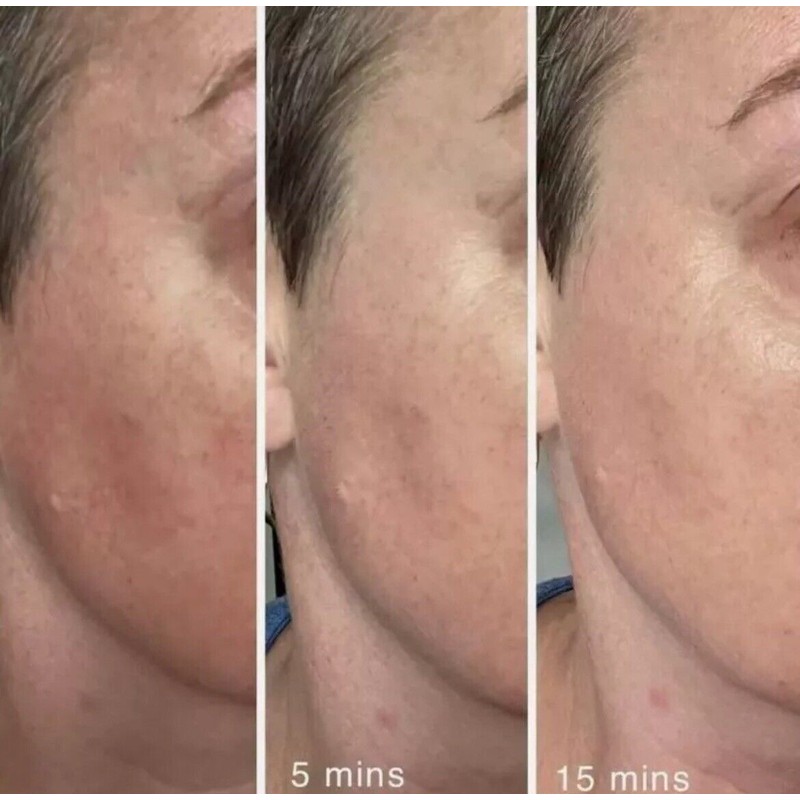 Epoch Cica Balm New Sealed