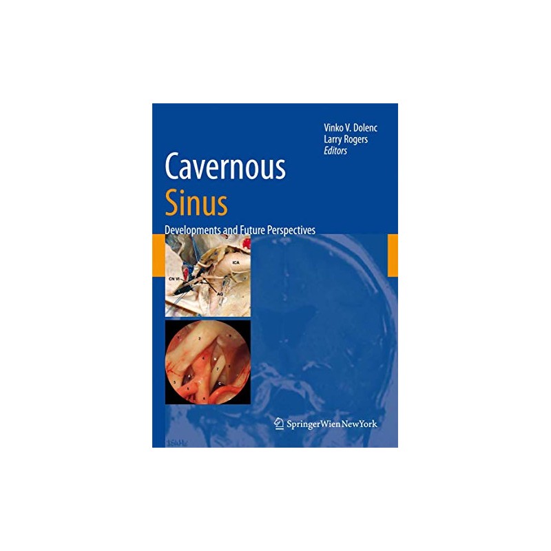 Cavernous Sinus: Developments and Future Perspectives