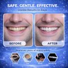 Teeth Whitening Strips Professional Strength – 21 Treatments (42 Strips)