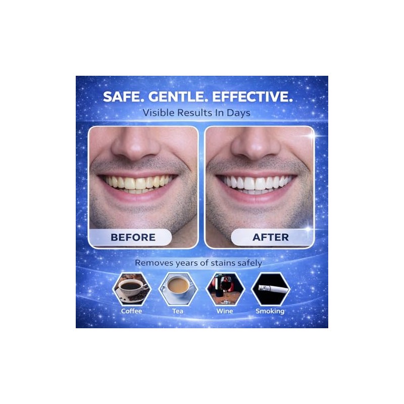 Teeth Whitening Strips Professional Strength – 21 Treatments (42 Strips)