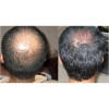Shampoo Estimulación Del Folículo, Mxshw-001, 1 Pza, 250ml