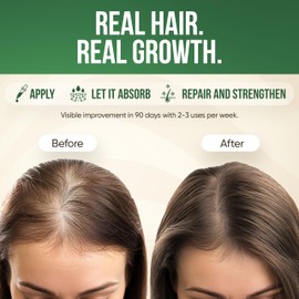 Morstar Batana Oil for Hair Growth - Dr Sebi Batana Hair Growth Oil from Honduras – 100% Pure, Natural & Cold-Pressed for Thicker, Longer Hair, Deep Hydration & Frizz Control 3.4oz