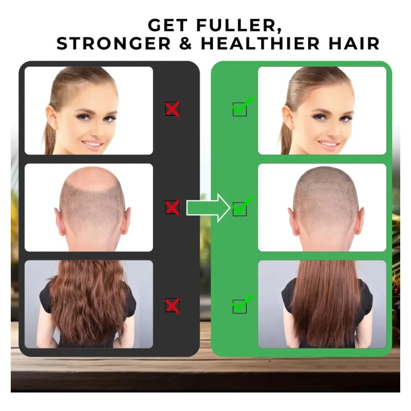 Aceite Para El Crecimiento Del Cabello Mysense Batana Crudo