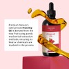 Aceite de Rosa Mosqueta Aekonik – Reduce cicatrices y arrugas,